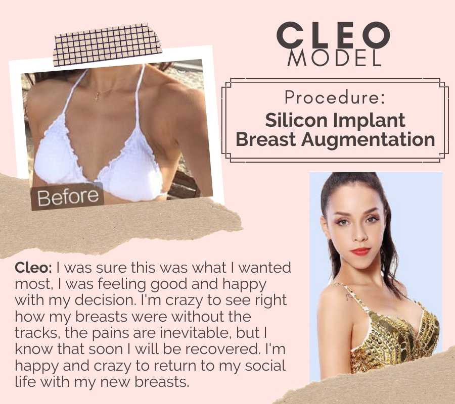 Breast Augmentation Before and After, Guangzhou, China